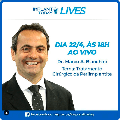 Implant today 22-04-2020 Marco Bianchini