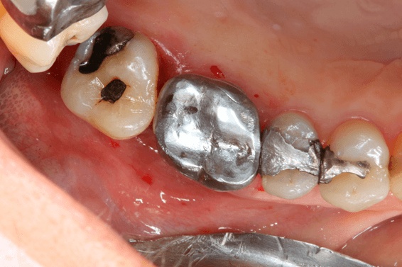 Figura 04 - matéria da semana 25/08/2021