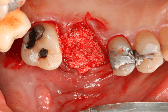 Figura 07 - matéria da semana 25/08/2021