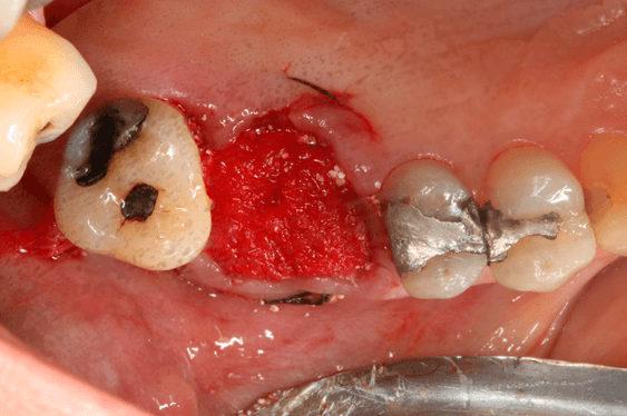 Figura 08 - matéria da semana 25/08/2021