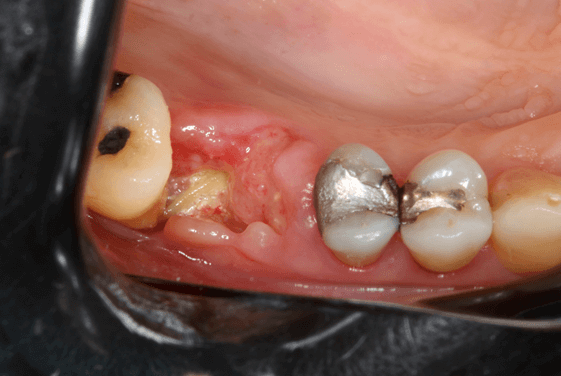 Figura 13 - matéria da semana 25/08/2021