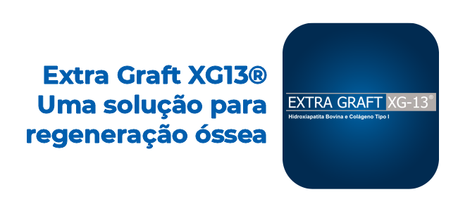 Extra Graft XG13® Uma solução para regeneração óssea