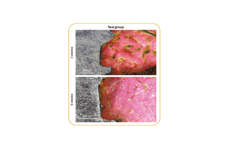Em dois momentos, 3 e 5 semanas, registrou-se sinais de maior estimulação e formação de tecido ósseo ao redor do implante nas amostras do grupo teste, em comparação as amostras do grupo Controle. (Dr. Sergio Gehrke)