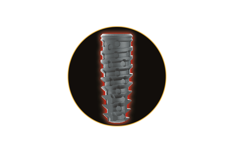 PERFIL CÔNICO para uma estabilidade, suporte e distribuição equilibrada de forças ao longo do corpo do implante.